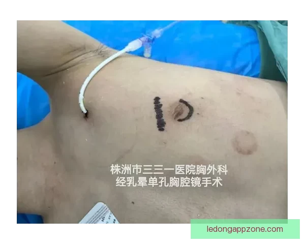 坎宁安气胸康复持续推进 活塞计划一周后复查评估